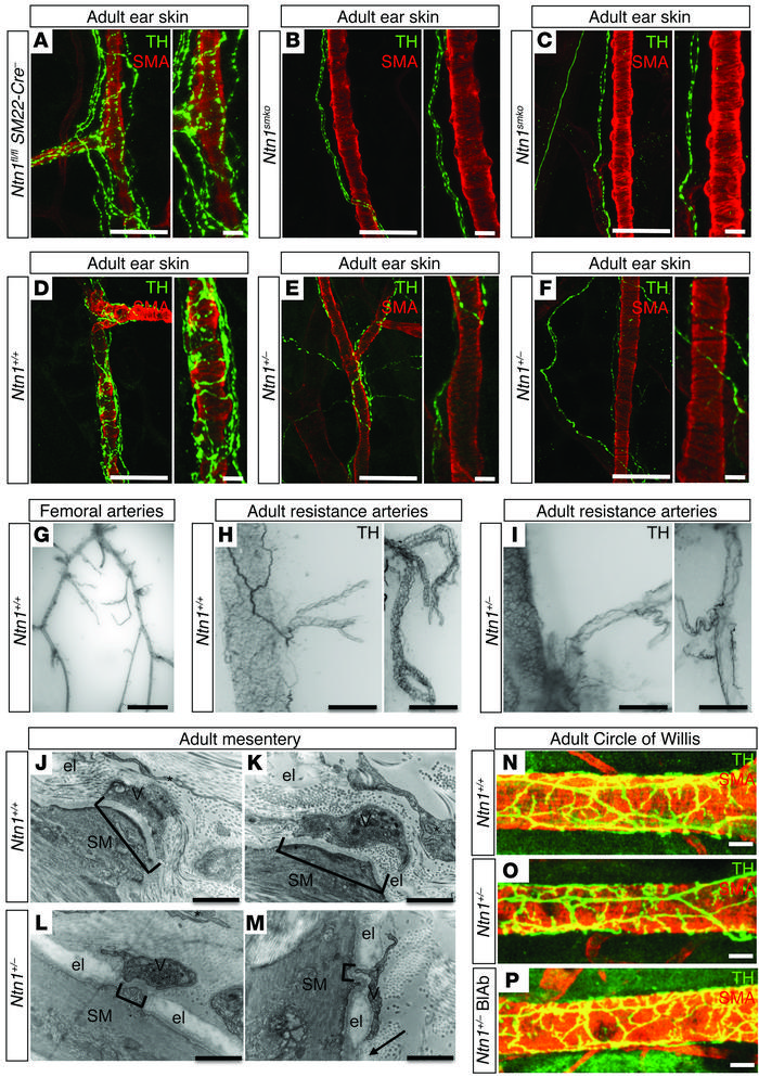 Innervation of peripheral resistance arteries in adult Ntn1-deficient mi...