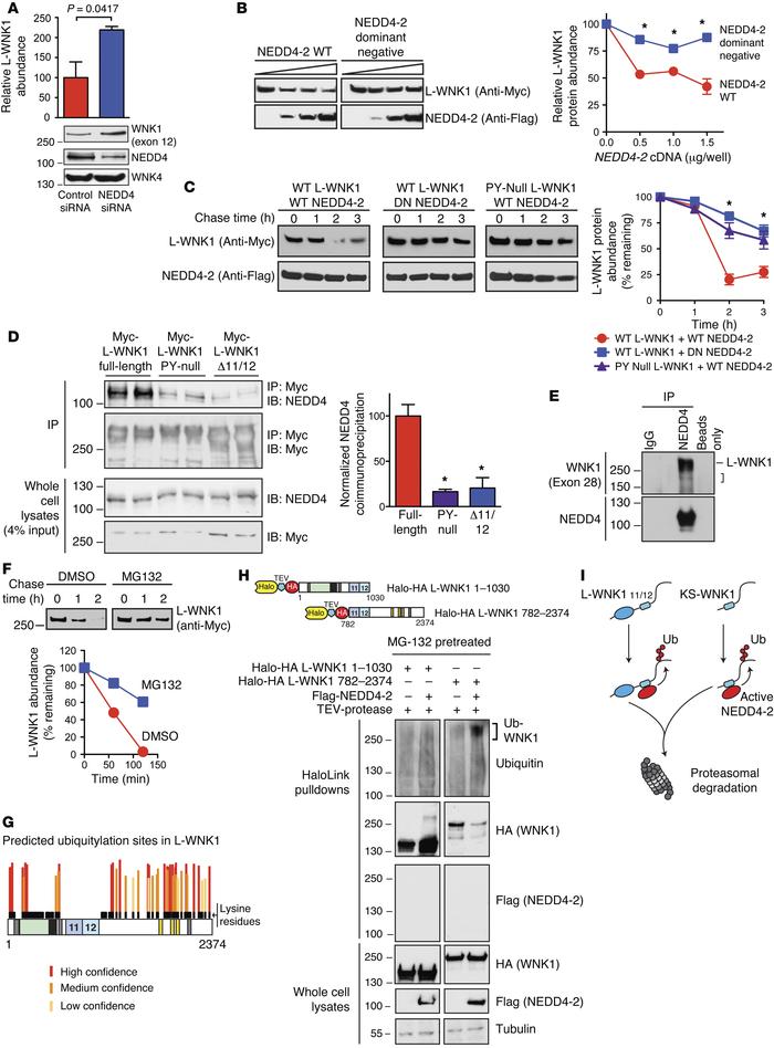 PY motif–containing WNK1 isoforms are NEDD4-2 substrates.
(A) Pan-NEDD4 ...