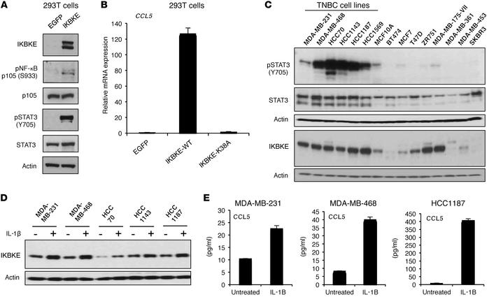 IKBKE promotes inflammatory signaling and is induced by IL-1 in TNBC cel...