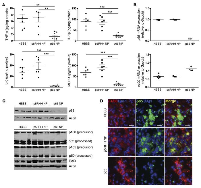 p5RHH-p65 siRNA nanoparticles downmodulate inflammatory cytokine product...