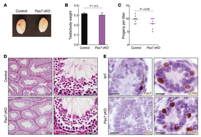 Pax7 cKO in the male germline.
For each analysis, n = 3 animals were eva...