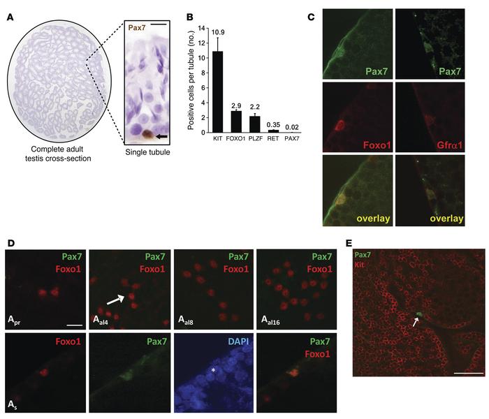 PAX7+ spermatogonia in normal testes.
(A) Rarity of PAX7+ cells in adult...