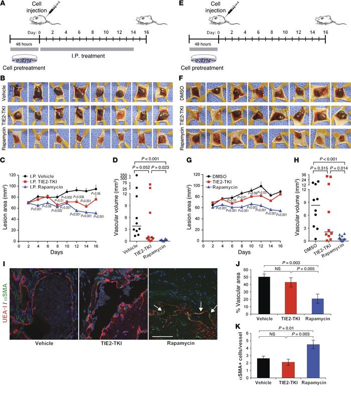 TIE2-TKI and rapamycin effects on murine VMs.
(A) Pretreatment plus i.p....