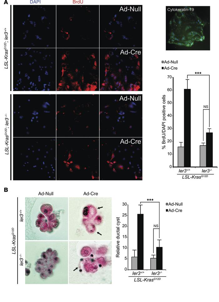 IER3 has a cell-autonomous role in early PanIN development.
(A) BrdU inc...