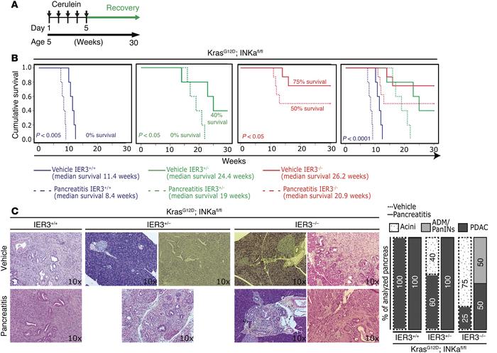IER3 is necessary for pancreatitis-associated tumorigenesis in KrasG12D;...