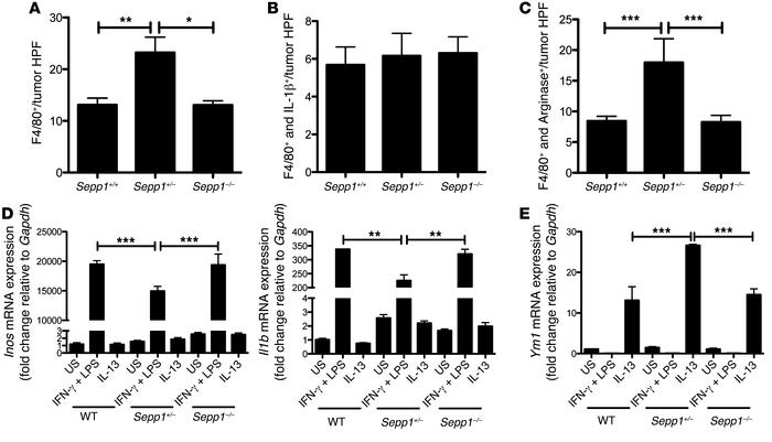 SEPP1 regulates protumorigenic M2 macrophage polarization.
Quantificatio...