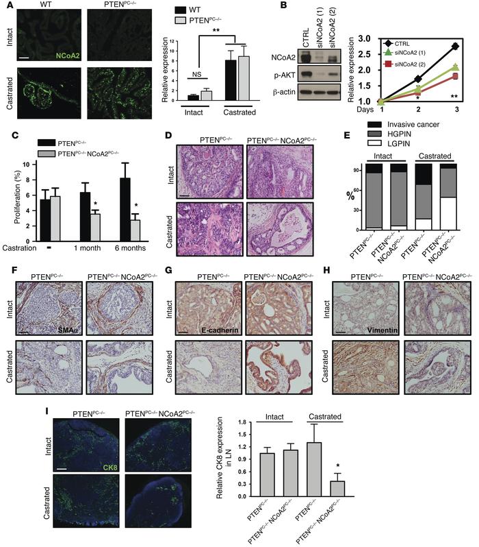 Upregulation of NCoA2 during androgen deprivation is critical in metasta...