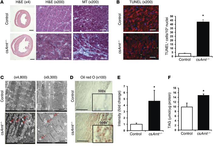 csArnt–/– hearts display increased lipid accumulation.
(A) Representativ...