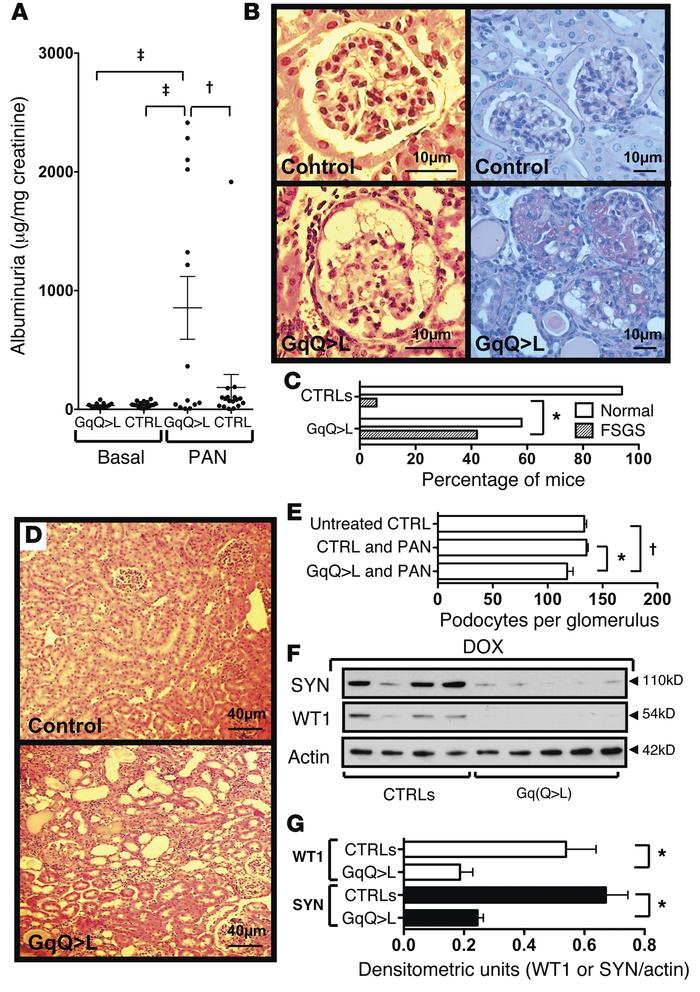 Effect of GqQ&gt;L induction on PAN nephrosis.
(A) PAN caused a signific...