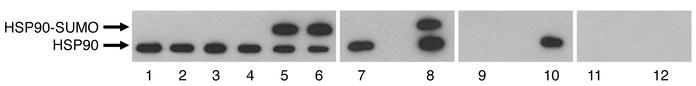 HSP90-SUMO1 in patients and in healthy donors.
Western blot (lanes 1–6) ...