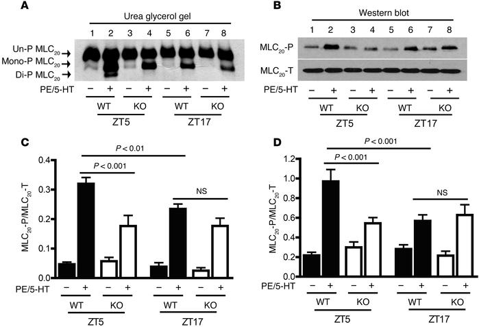 The time-of-day variations in agonist-induced MLC20 phosphorylation are ...