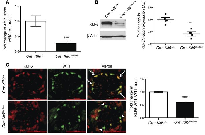 Podocyte-specific knockdown of Klf6 in Podocin-Cre Klf6fl/fl mice was co...