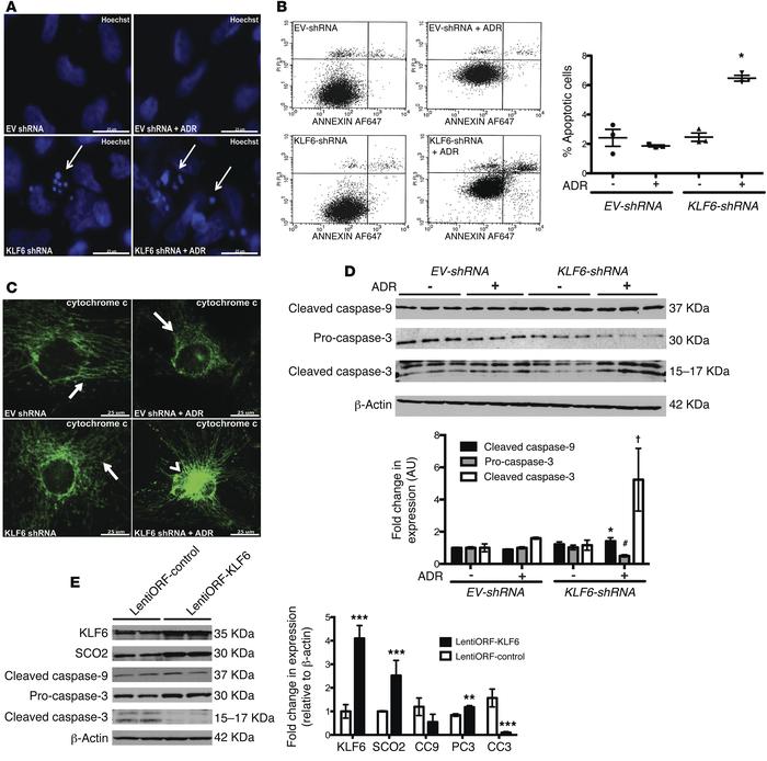 shRNA-mediated KLF6 knockdown resulted in activation of the intrinsic ap...