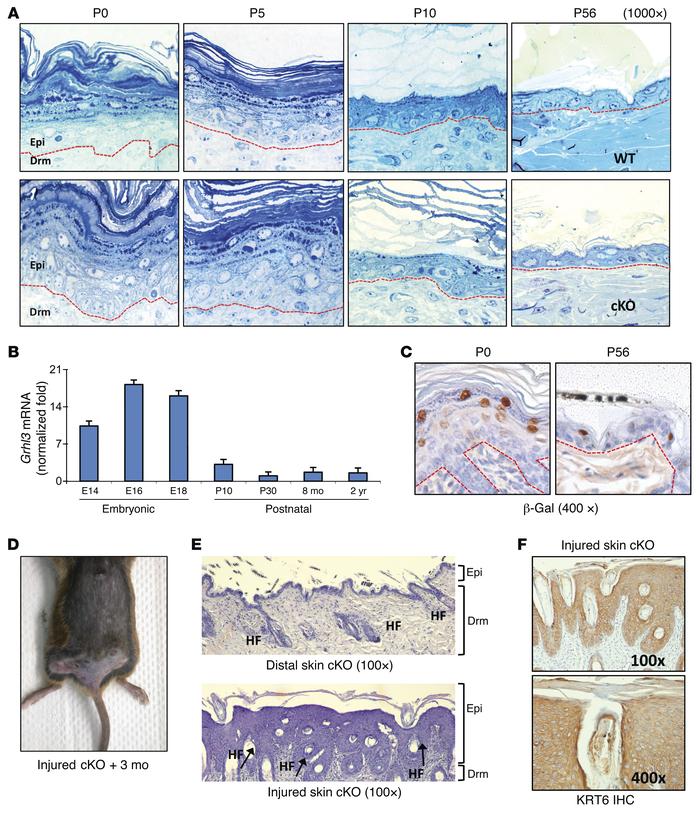 Grhl3 is dispensable for epidermal differentiation in the adult mouse, b...