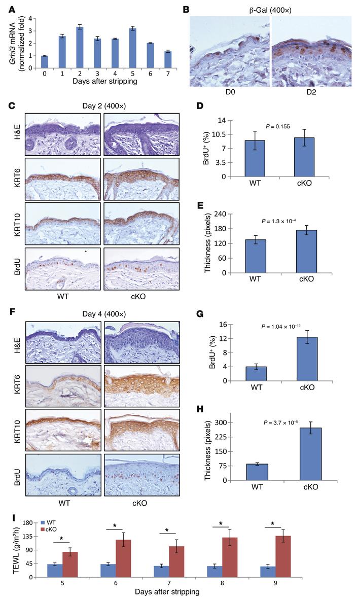 Loss of Grhl3 impairs adult mouse epidermal barrier repair.
(A) Grhl3 mR...