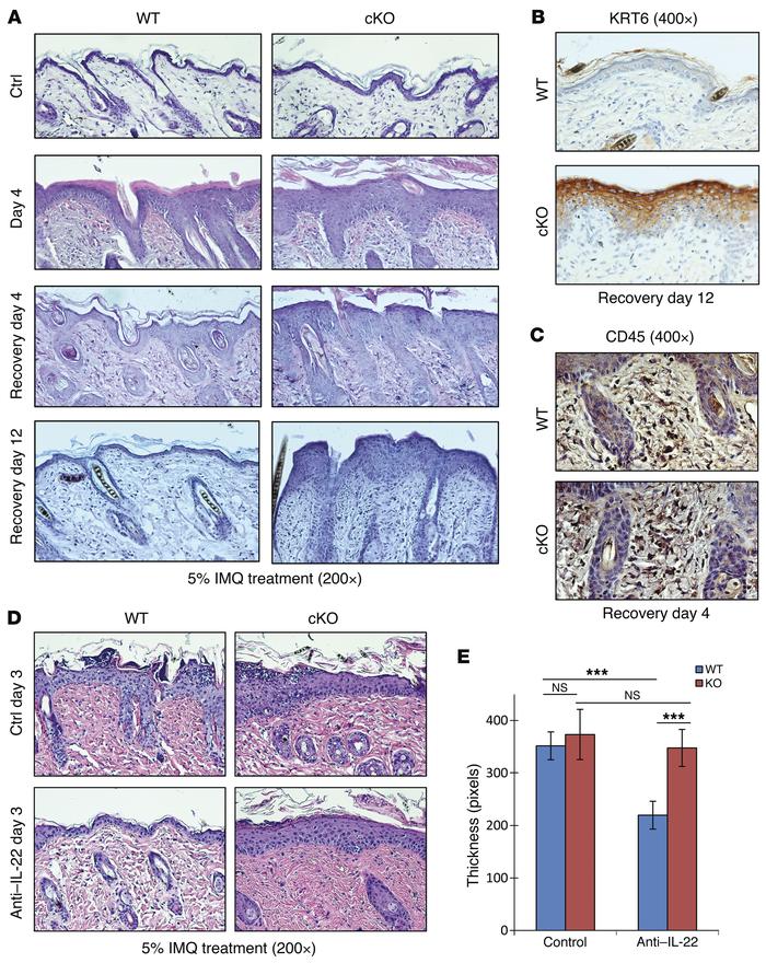 Grhl3 is required for healing of immune-mediated epidermal lesions.
(A) ...