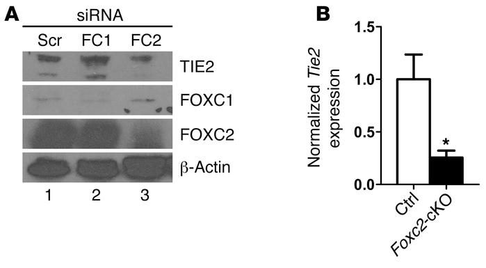 FOXC2 regulates TIE2 expression in the lymphatic endothelium.
(A) Human ...