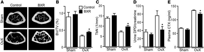 Protective effect of pharmacological RXR activation on bone loss.
(A) Re...