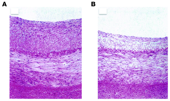 The greatly thickened intima of a porcine ileofemoral artery after ballo...