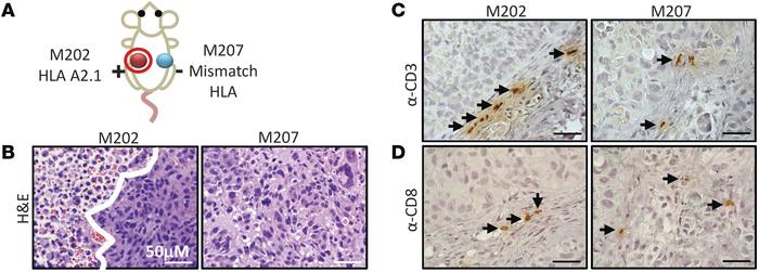 Immunohistochemistry of immune infiltrates from xenografts removed from ...