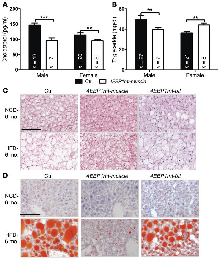 
Tg-4EBP1mt-muscle mice have improved fat metabolism on HFD.
(A) Cholest...