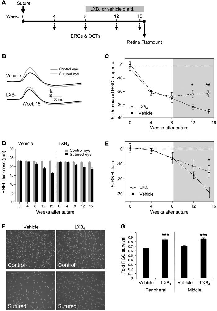 Therapeutic LXB4 protects RGC function and survival following glaucomato...