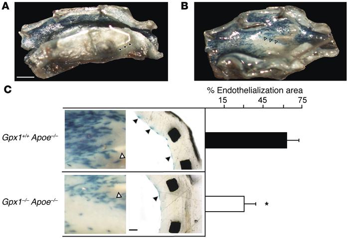 Stent endothelialization is impaired in Gpx1-deficient mice.
In Gpx1–/– ...