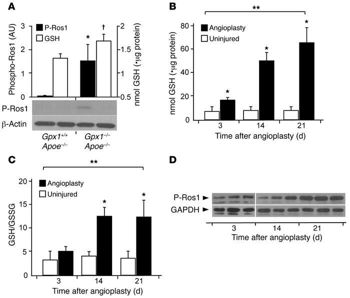 GPX1 deletion–dependent reductive stress activates ROS1.
(A) ROS1 activi...