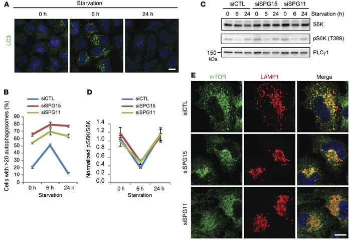 A failure of clearance of autophagosomes in spastizin- or spatacsin-depl...