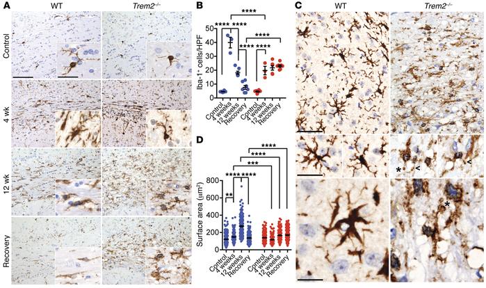 
Trem2 deficiency impairs microglial response to demyelination.
Corpus c...
