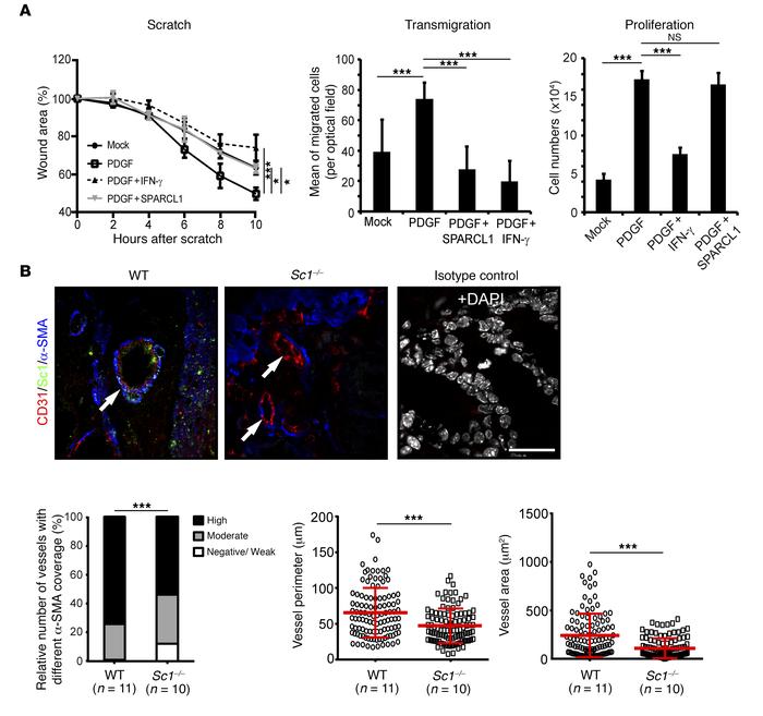 SPARCL1 regulates vessel maturation.
(A) Primary human SMCs were treated...