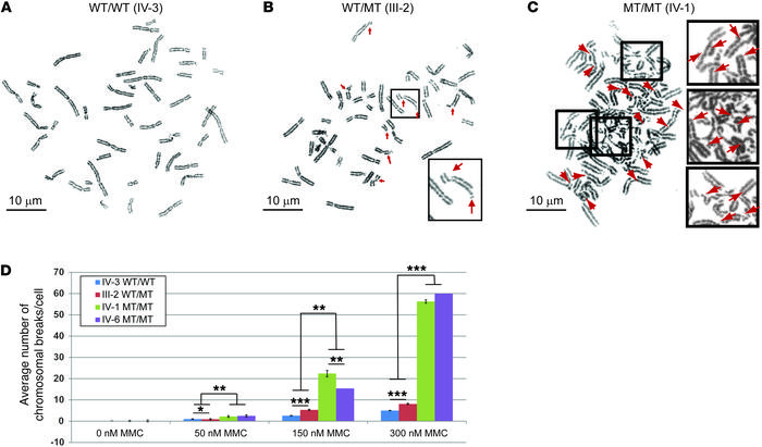 MCM8 mutation impairs DNA break repair.
Cells from homozygous MCM8 c.446...