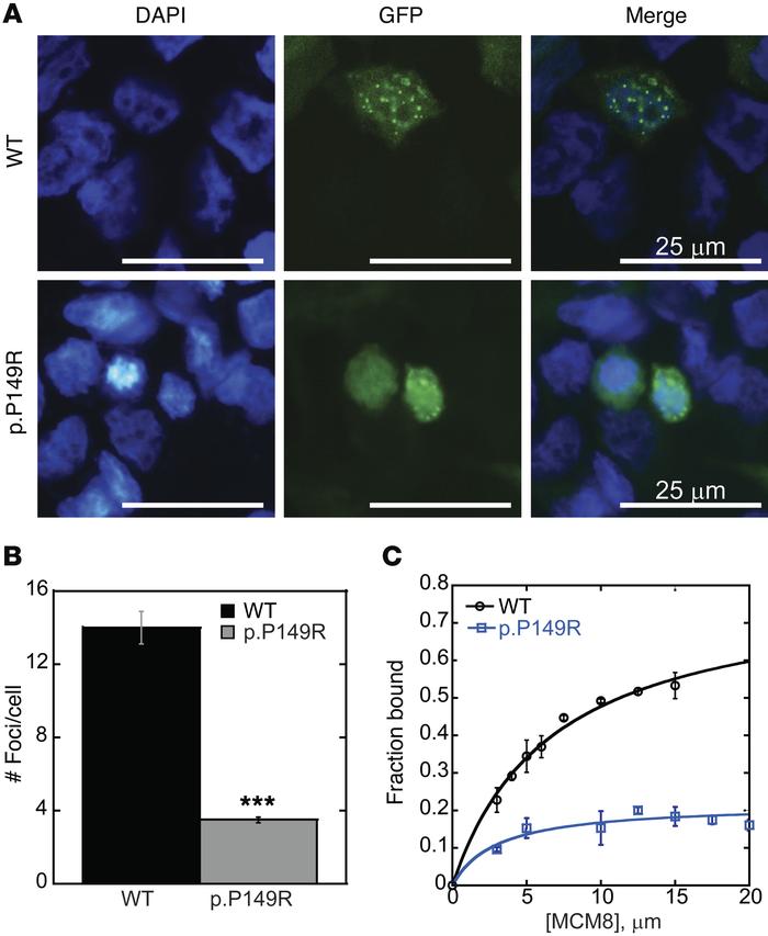 MCM8 mutation disrupts MCM8 foci formation and DNA binding.
(A) MCM8 c.4...