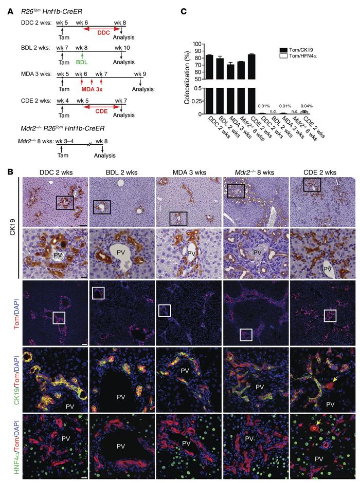 DRs arise from the biliary HNF1β+ compartment in a broad range of liver ...