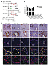 DRs arise from the biliary HNF1β+ compartment in a broad range of liver inj