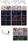 Minimal contribution of DRCs to hepatocyte neogenesis after long-term liver