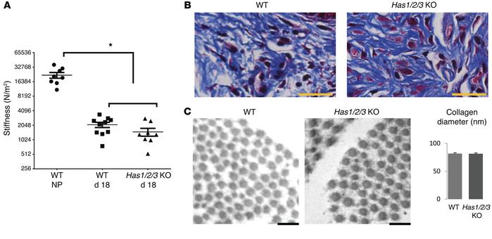 HA is not obligatory for increased tissue compliance during cervical rip...