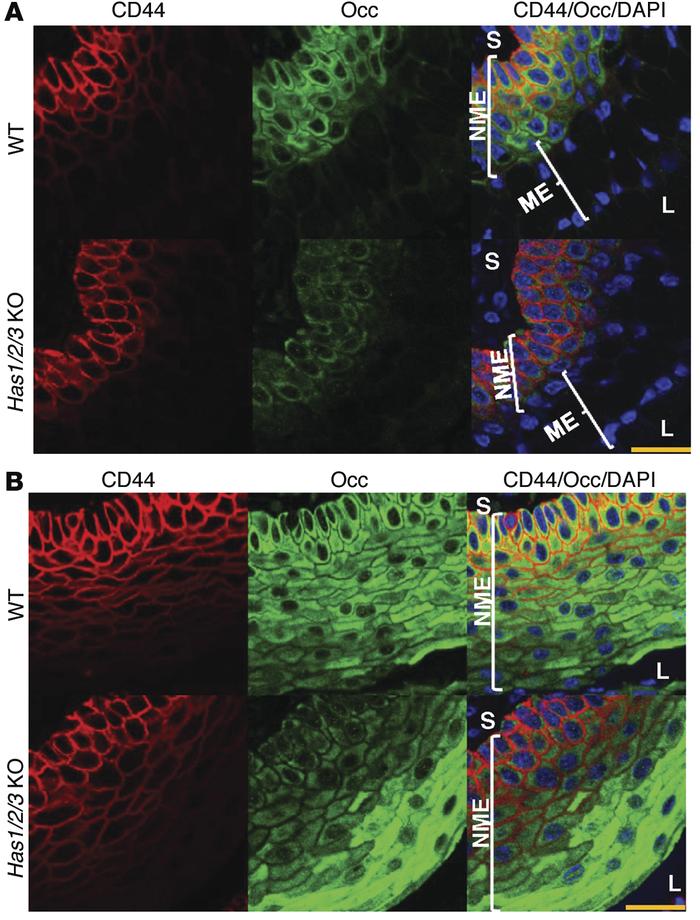 HA depletion diminishes occludin expression in CD44+ epithelia.
(A) CD44...