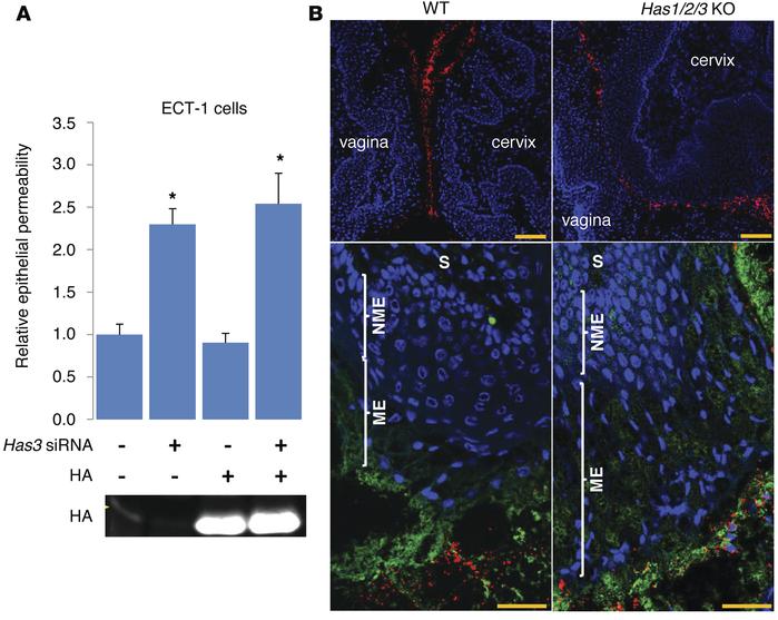 HA depletion compromises epithelial and mucosal barrier functions.
(A) s...