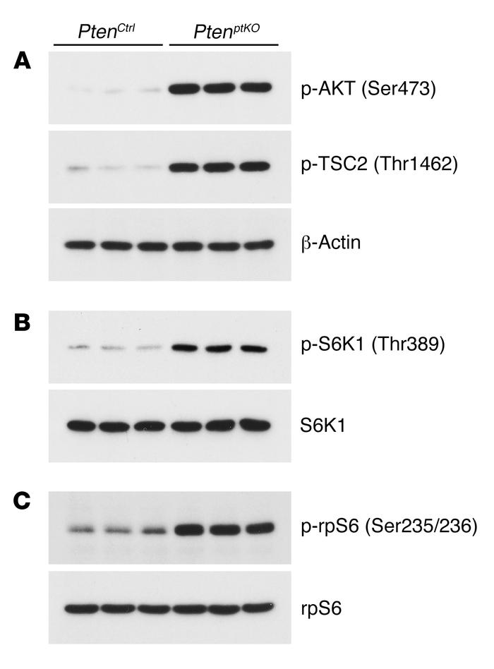 Renal proximal tubular cell–specific Pten deletion activates the AKT/TSC...