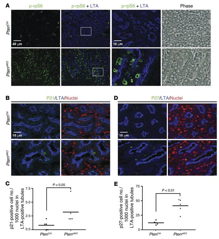 Renal proximal tubule–specific Pten KO increases rpS6 phosphorylation an...