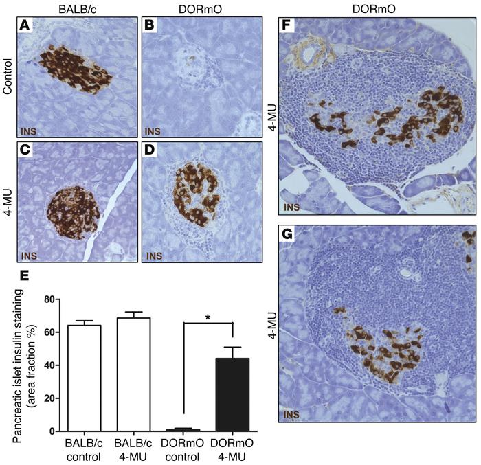 4-MU treatment promotes nondestructive insulitis.
(A–D) Insulin staining...