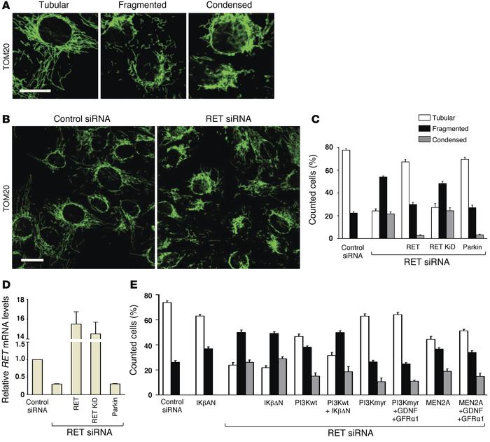 RET knockdown in SH-SY5Y cells induces mitochondrial network alterations...