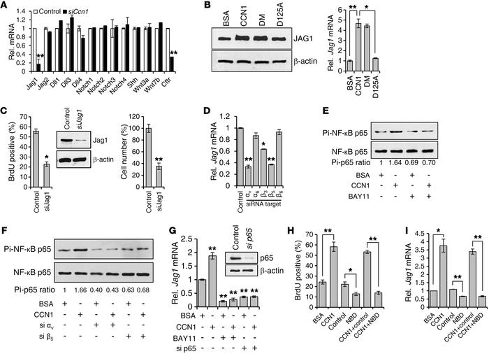 CCN1 promotes cholangiocyte proliferation through NF-κB–mediated Jag1 ex...