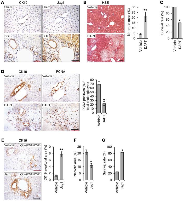 JAG1/NOTCH signaling is critical for biliary ductal reaction.
(A) Adjace...