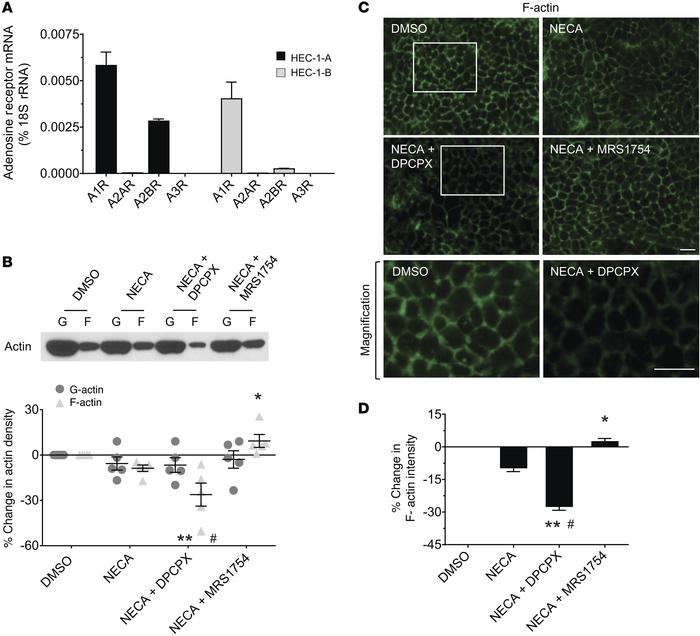 The adenosine A1R antagonist DPCPX decreases cortical F-actin.
(A) Adeno...