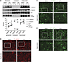 CPA increases membrane localization of E-cadherin, β-catenin, and Na+K+ ATP