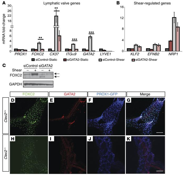 
GATA2 is required for flow-induced expression of lymphatic valve genes....