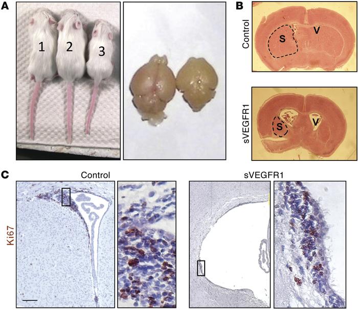 PVL-like pathology in sVEGFR1 mice.
(A) 30-day-old littermates in which ...