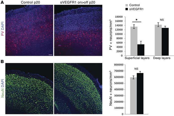 A deficit in cortical inhibitory GABAergic interneurons in sVEGFR1 mice....